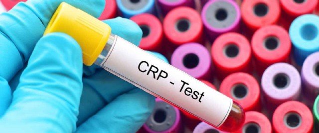 �Y� Partili ��ray�dan Sa�l�k Bakanl����na CRP testi sorusu!